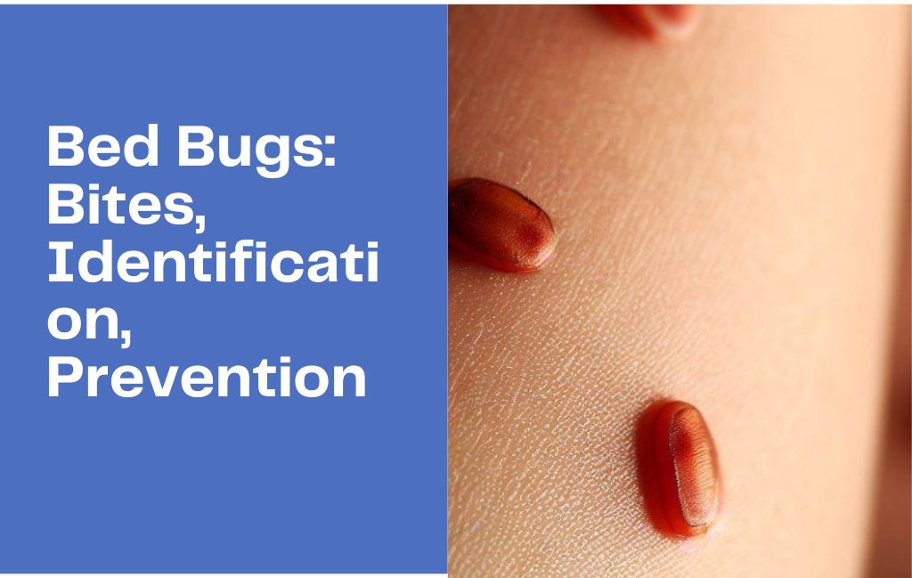 Bed Bugs Bites Identification Prevention And How To Choose The Bes 2024