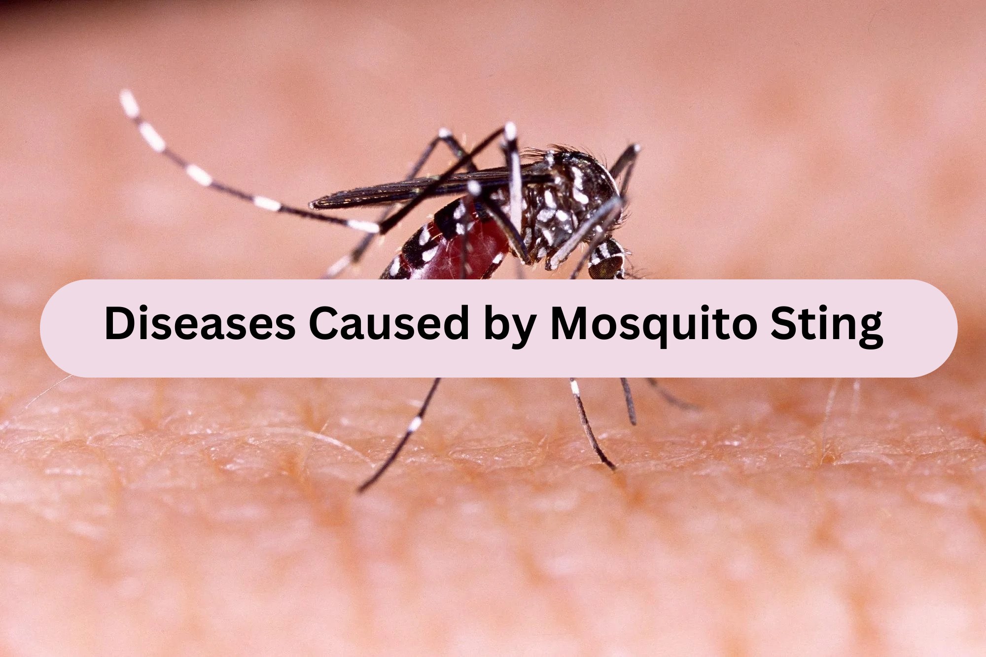 Diseases Caused by Mosquito Sting