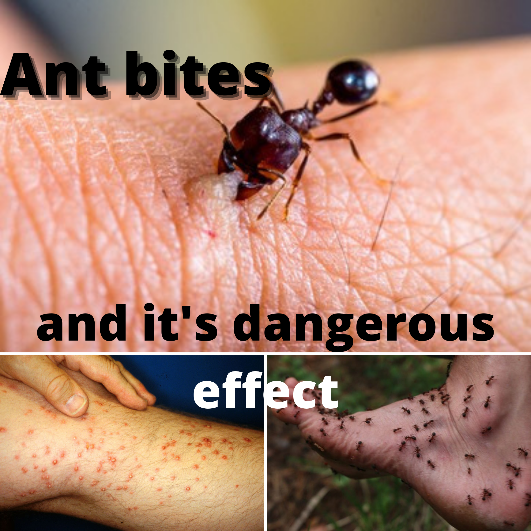 What should we do when an ant bites?