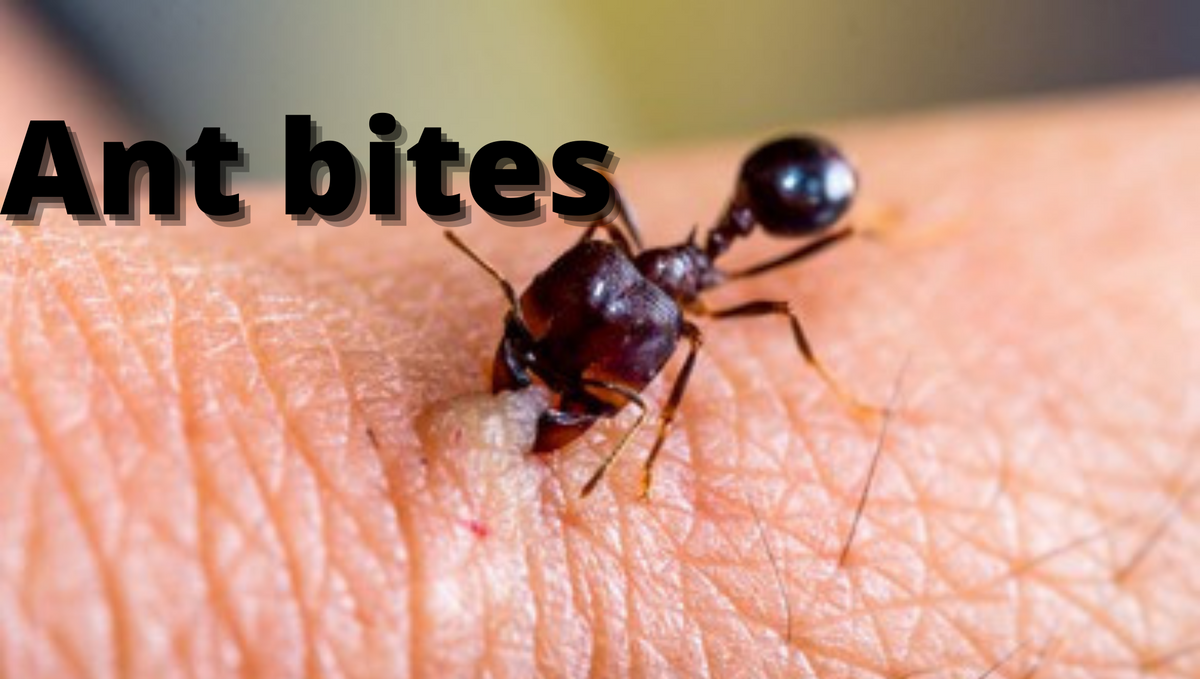 What should we do when an ant bites?