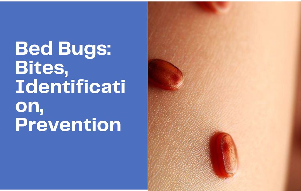 Bed Bugs: Bites, Identification, Prevention, and How to Choose the Best Bed Bug Killer