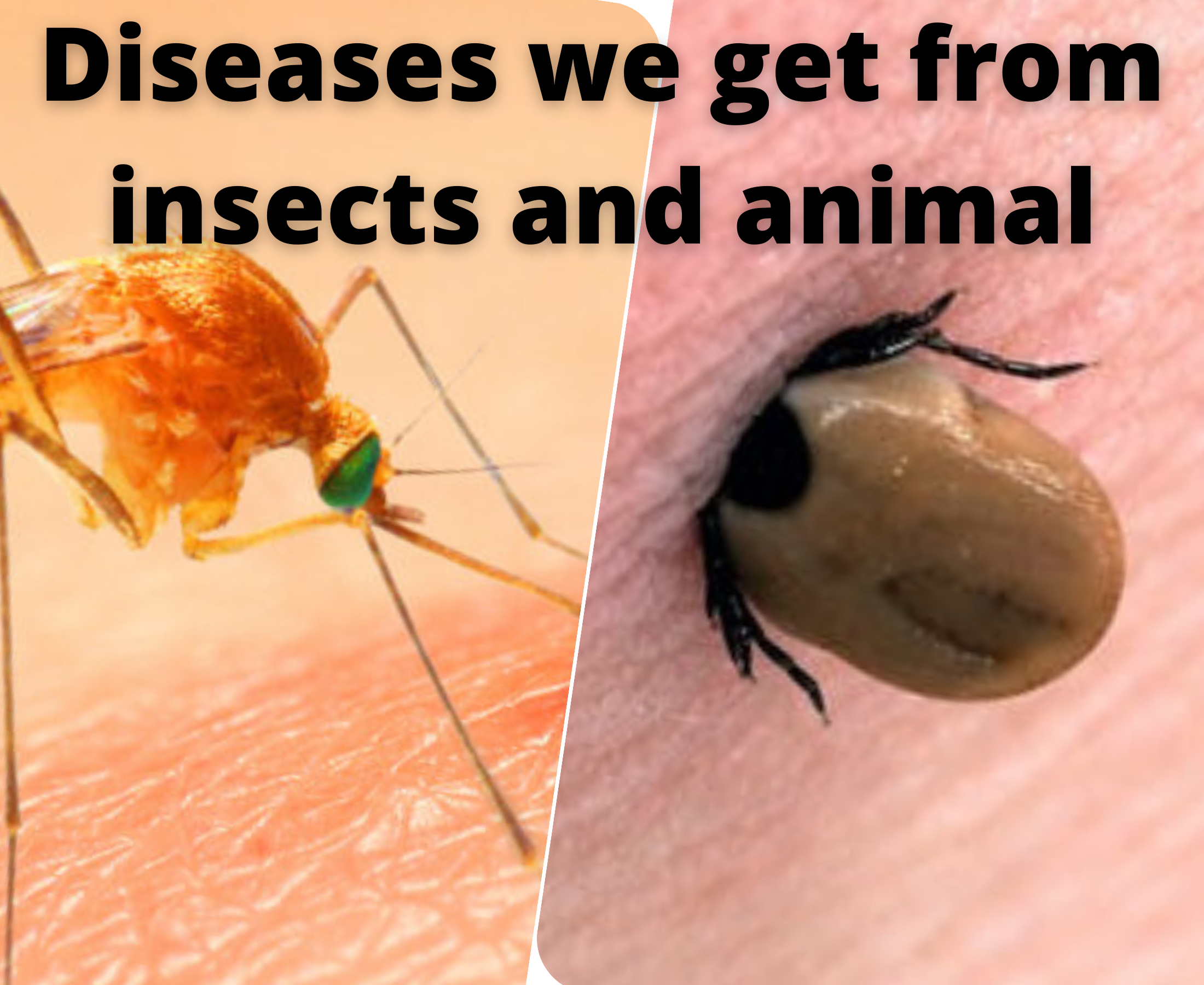 Which disease is transmitted by insect and animal bites?