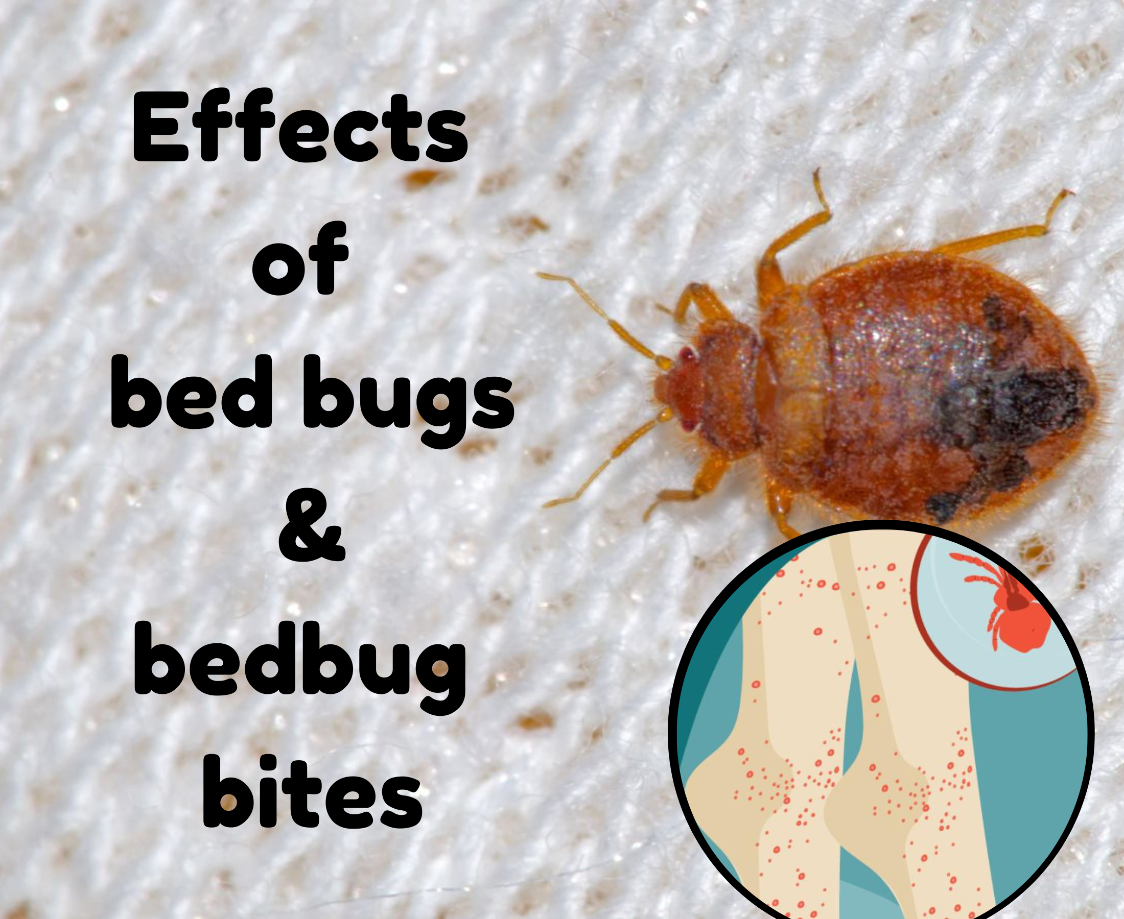 What are bed bugs? How do their bites affect you?