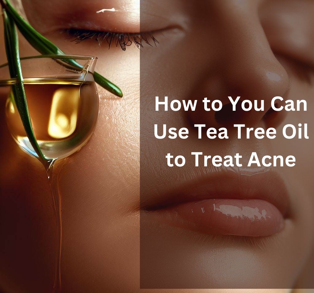 How to You Can Use Tea Tree Oil to Treat Acne