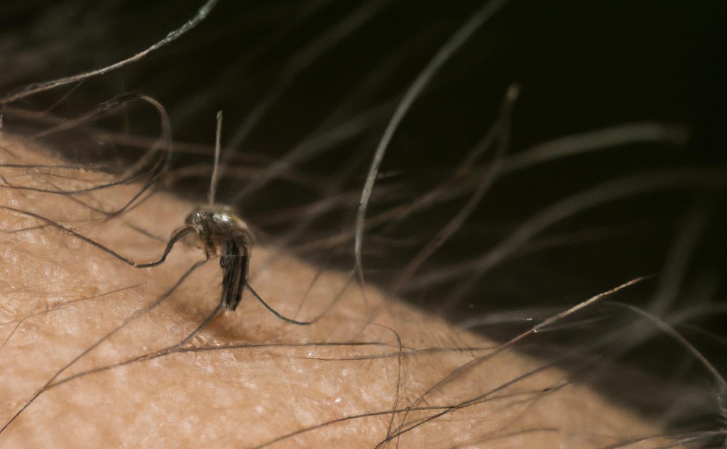 How Body Hair Protects Us Against Fleas and Bed Bugs